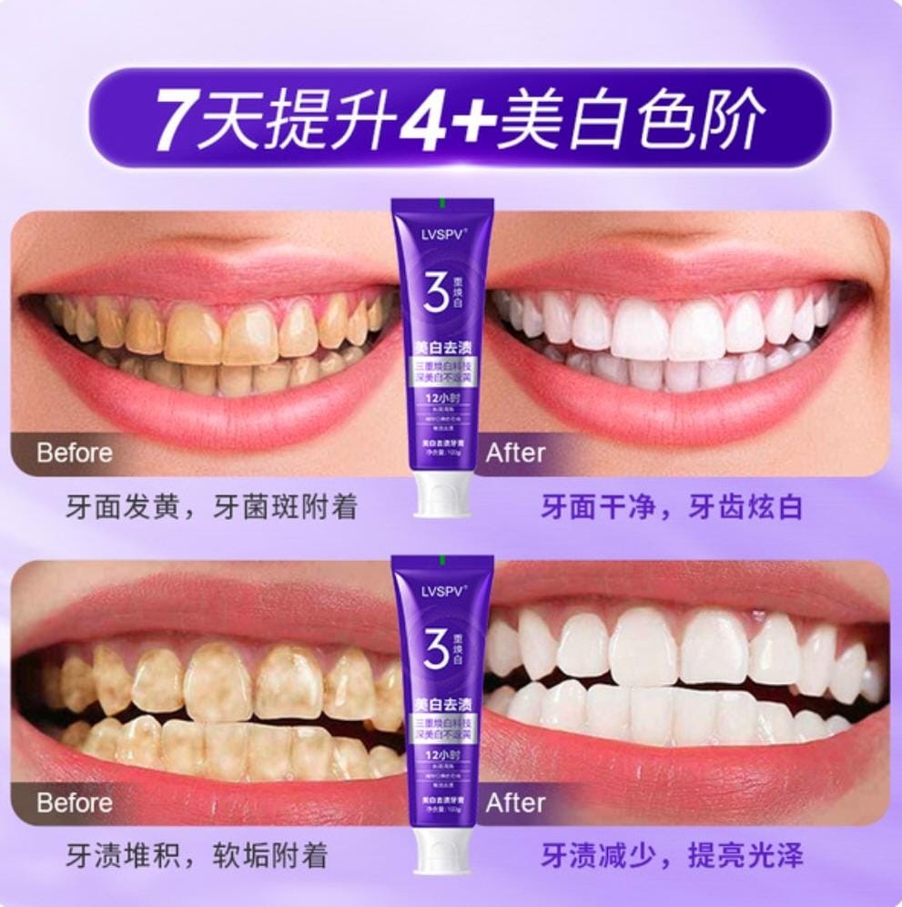 Color Repair Whitening Toothpaste Manufacturer Direct Sales Purple Light Popping Toothpaste to Remove Yellowing and Remove Bad Breath Color Repair Toothpaste Best Selling List